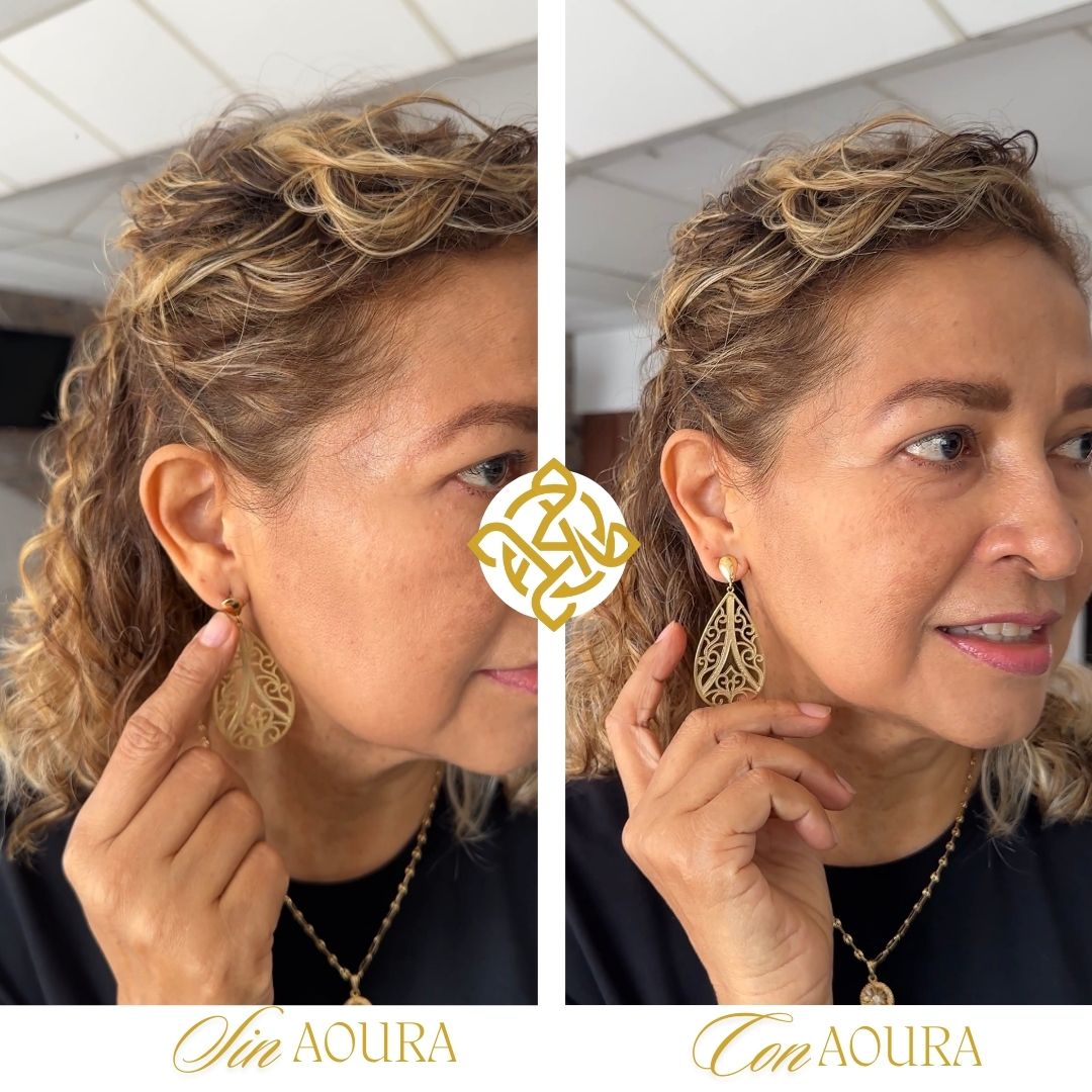 Levantadores de aretes Aoura®